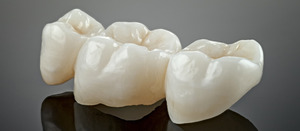 Close-up of a ceramic dental bridge on a grey background